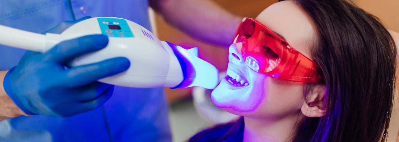 Everything You Need To Know About Teeth Whitening