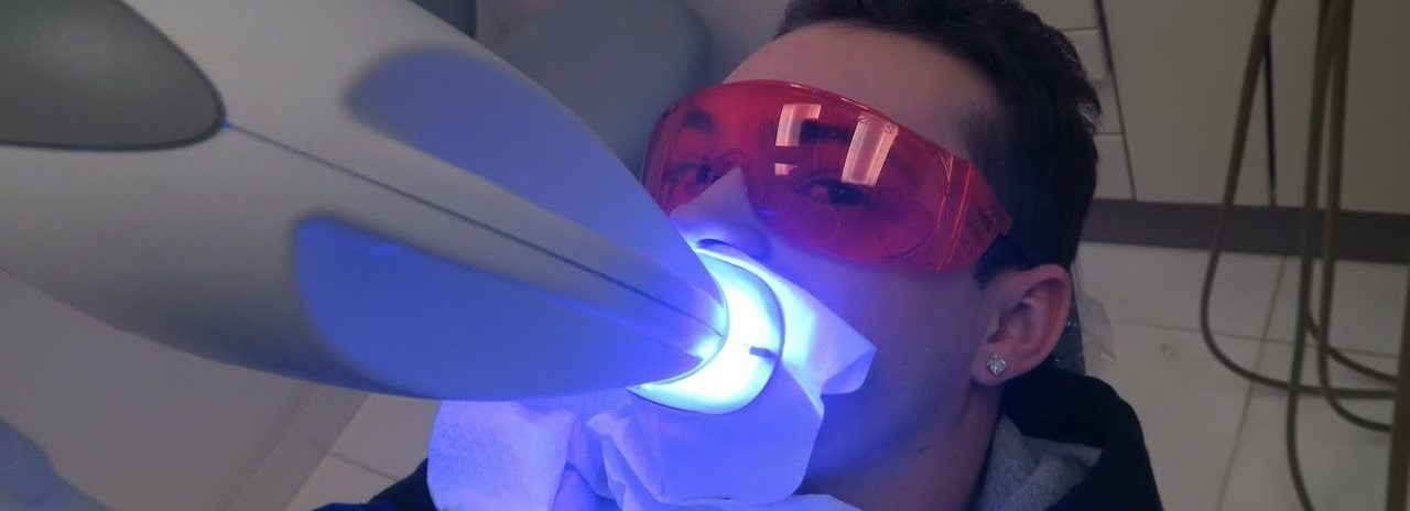 The Benefits of Professional Teeth Whitening Services